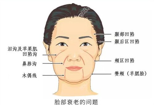 上海光博士皮肤美容医院面部抗衰卡通图