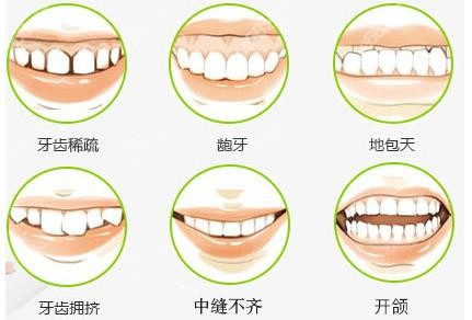 北京张建朋做正畸怎么样？根据牙齿问题分型改善