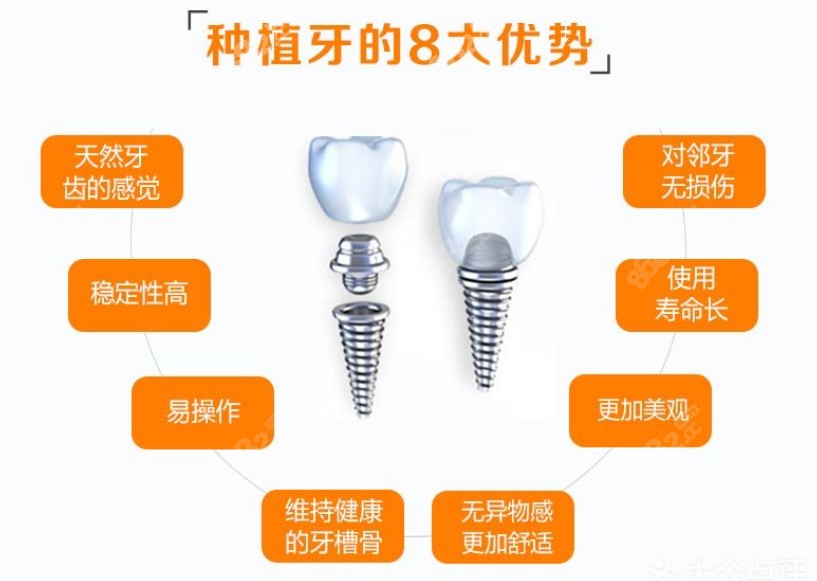 牙齿缺失做种植牙的8大优势来看看