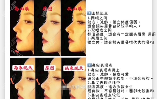 郑州美莱医疗美容医院隆鼻