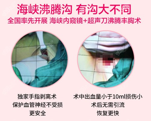 福州海峡乳房整形手术优势