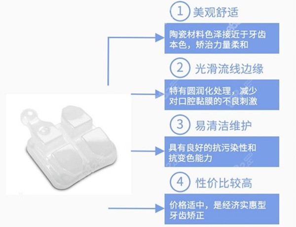 鄂尔多斯牙齿矫正的费用