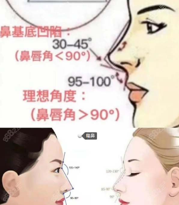 隆鼻中对鼻尖和鼻头的处理