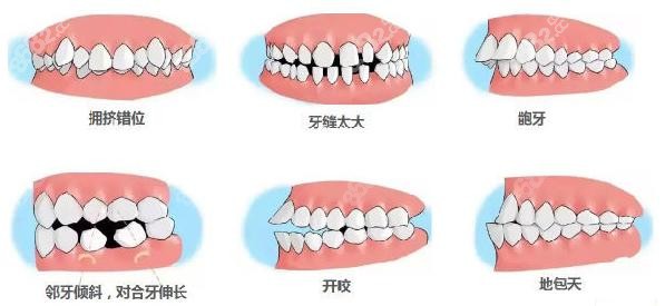 說嘉興曙光整形口腔是嘉興做牙齒矯正好的醫(yī)院因?yàn)闈M足不同顧客的矯牙需求 說嘉興曙光整形口腔是嘉興做牙齒矯正好的醫(yī)院因?yàn)闈M足不同顧客的矯牙需求