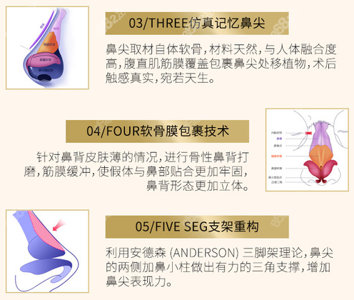 软骨+筋膜双组合隆鼻