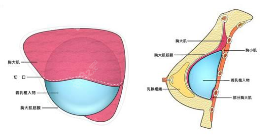 <!--<i data=20240705-sp></i>-->陈郇隆胸