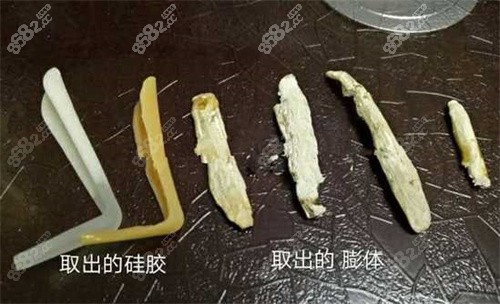 <!--<i data=20240705-sp></i>-->医美隆鼻假体