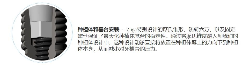 儒伽种植体的优势