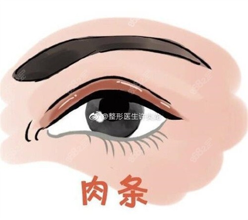 肉条感修复