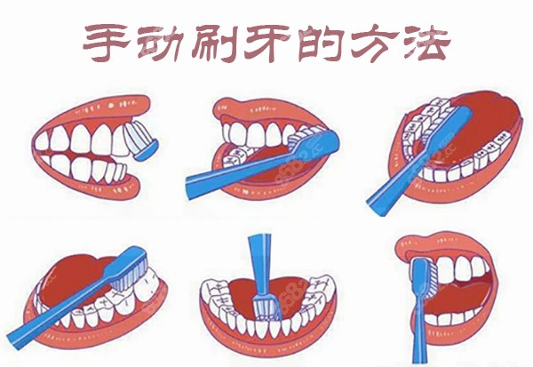 隐适美矫正器的原理一