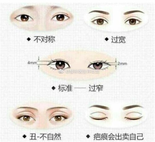 眼部需要修复情况