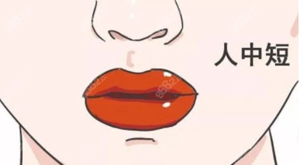 正畸后人中会显得长