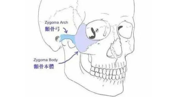 牙齿矫正会导致法令纹加深