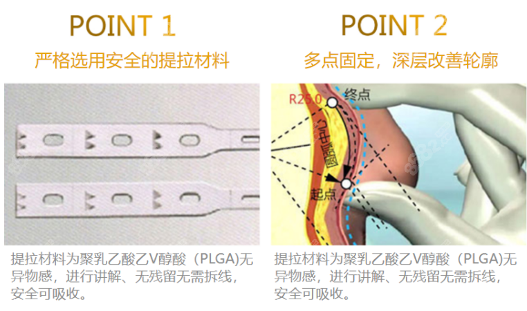 北京美莱拉皮价格