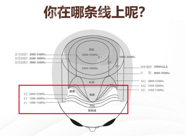 不同区域植发数量对照图