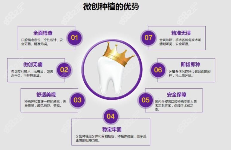 微创种植牙优势