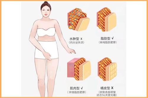 北京王明利吸脂技術好