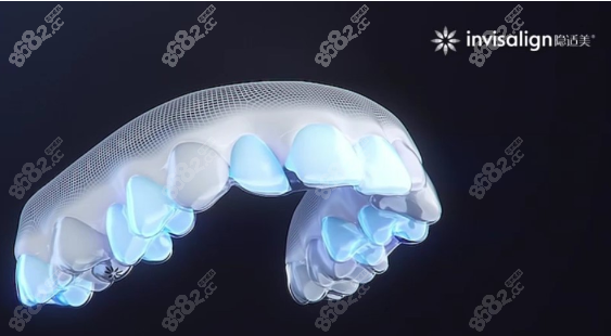 上海口腔诊所价目表-牙齿矫正价格 上海口腔诊所价目表-牙齿矫正价格