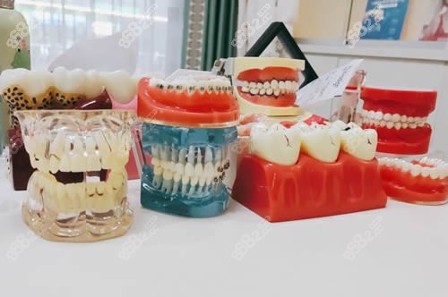 福州登特口腔牙齿治疗模型展示