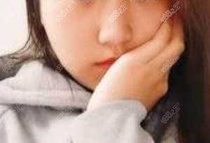 <!--<i data=20240705-sp></i>-->下颌角截骨范例术前 <!--<i data=20240705-sp></i>-->下颌角截骨范例术前