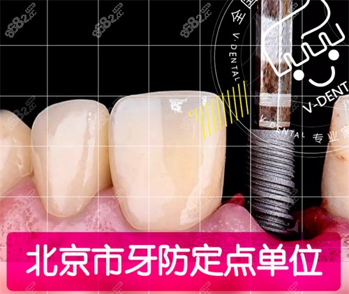 <!--<i data=20240705-sp></i>-->口腔种植牙宣传图