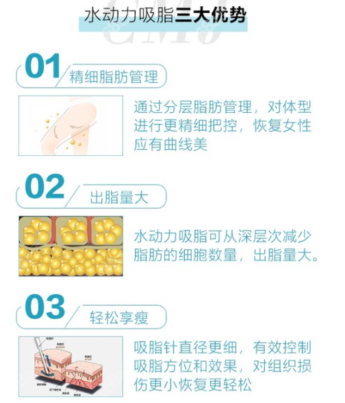 烟台鹏爱佳妍整形水动力大腿吸脂价格