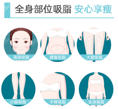 烟台鹏爱佳妍整形做水动力吸脂部位