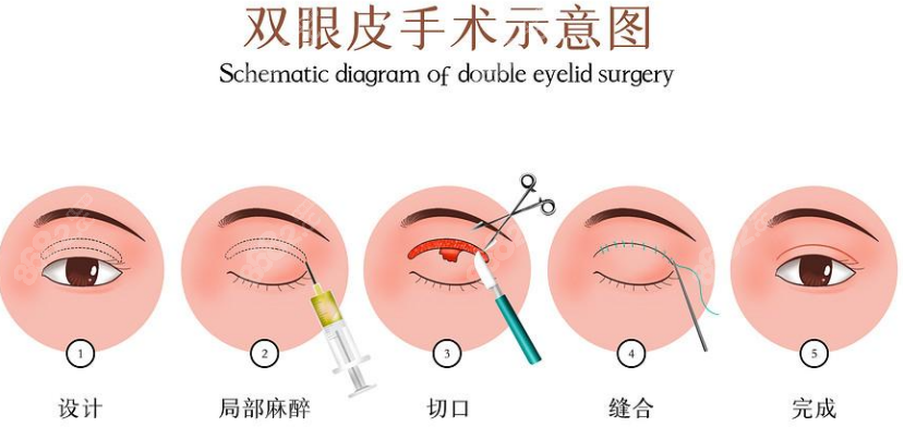 甘泉涌医生技术怎么样