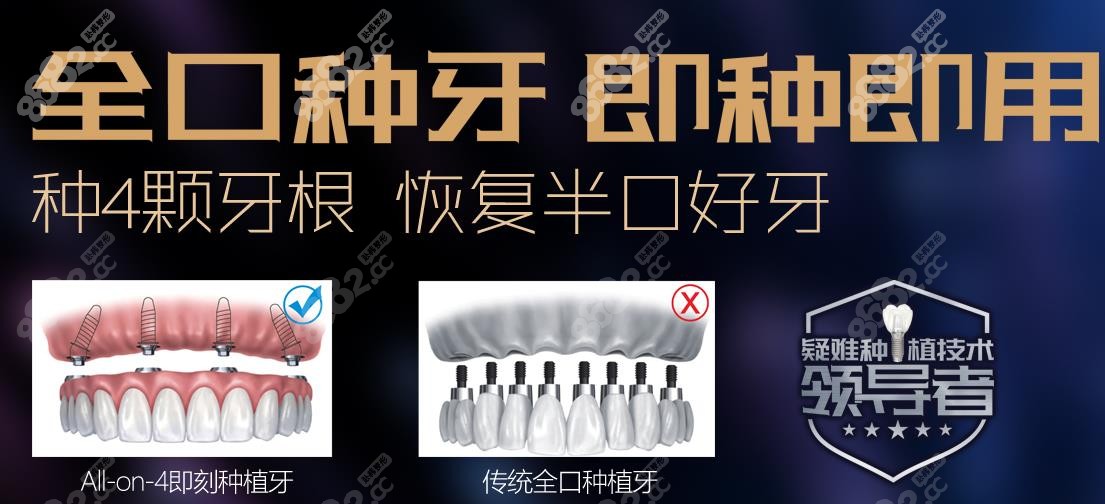好民生全口种植牙的优势