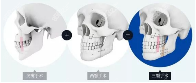 <!--<i data=20240705-sp></i>-->做正颌手术的技术还是挺靠谱的