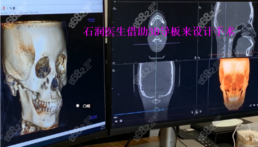 <!--<i data=20240705-sp></i>-->怎么樣