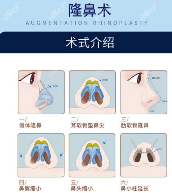 张尚风鼻子做得好吗？
