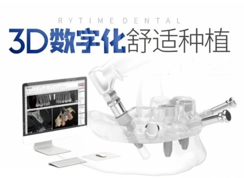 牙博士口腔种植牙技术优势