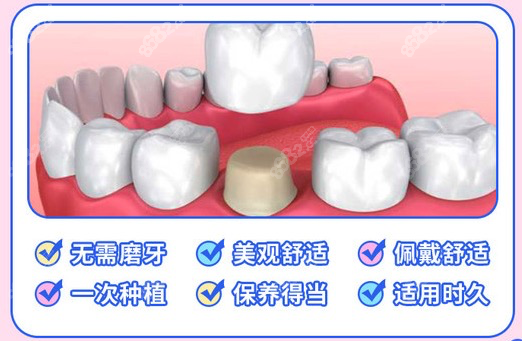 维恩口腔种植牙好不好