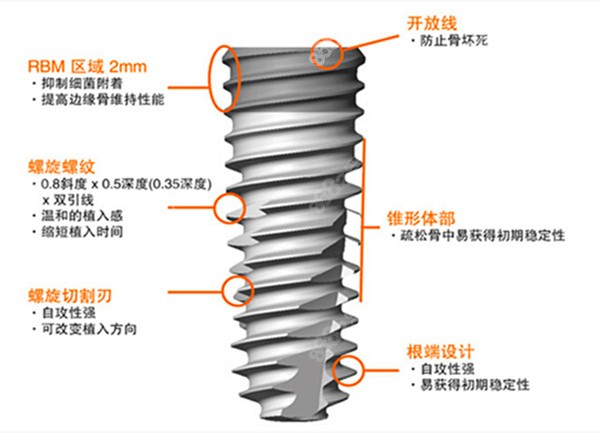 瑞典诺贝尔植体设计的优点图