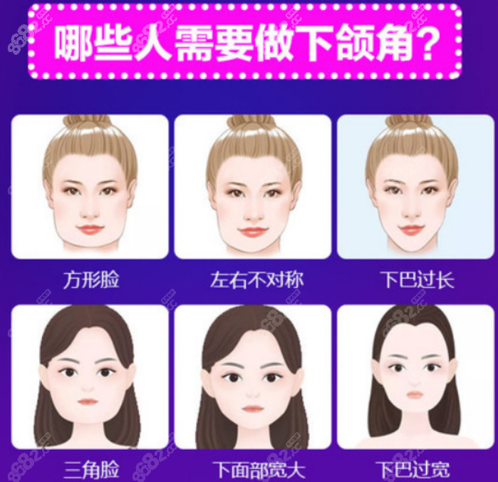 廣州廣大柳超醫(yī)生有磨骨資質(zhì)嗎