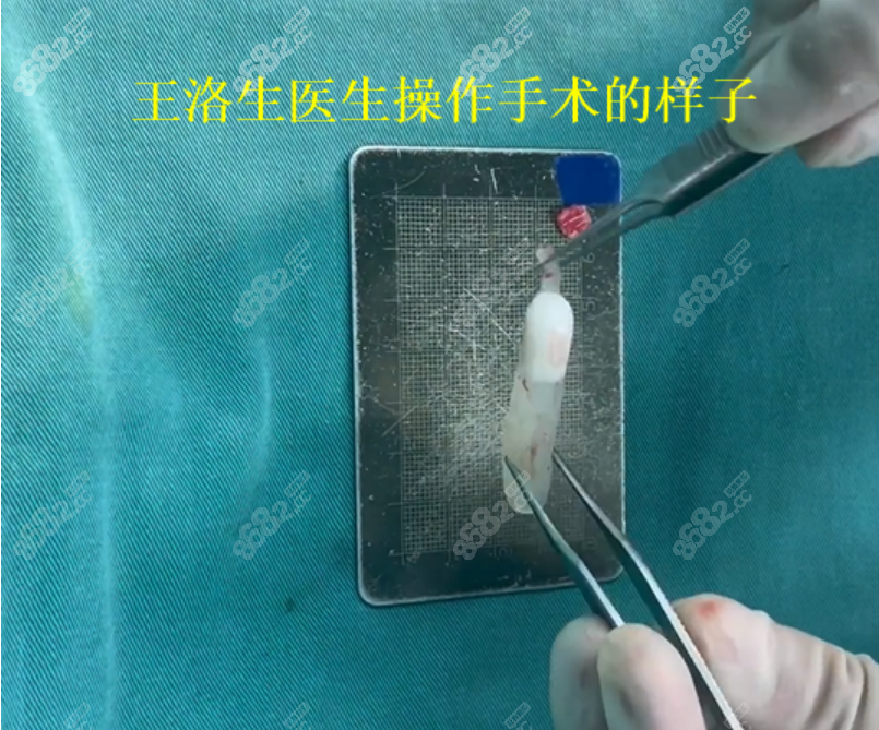 郑州王洛生医生做鼻子的优势