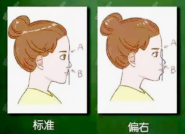 18岁做牙齿矫正还有用吗