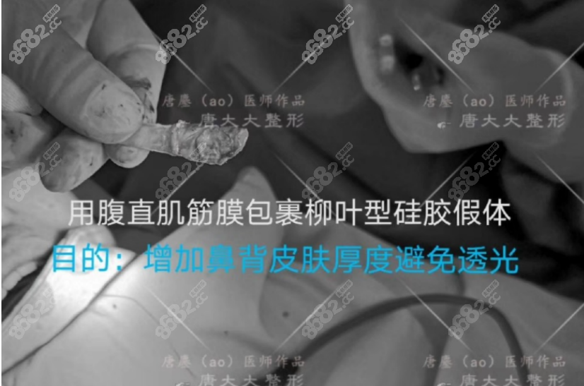 上海唐鏖做鼻子怎么样