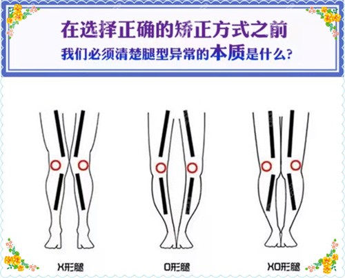 国内腿型矫正医院排名前20强
