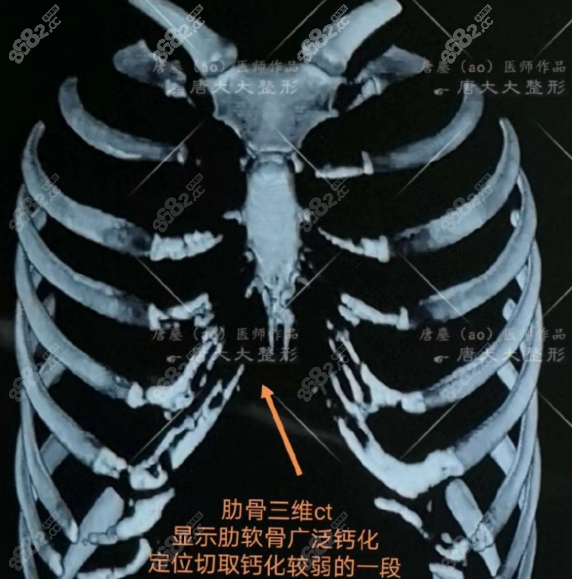 上海唐鏖医生做鼻子的优势