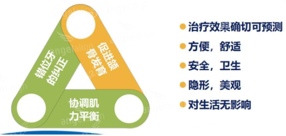 时代天使儿童版牙套KID型号优势