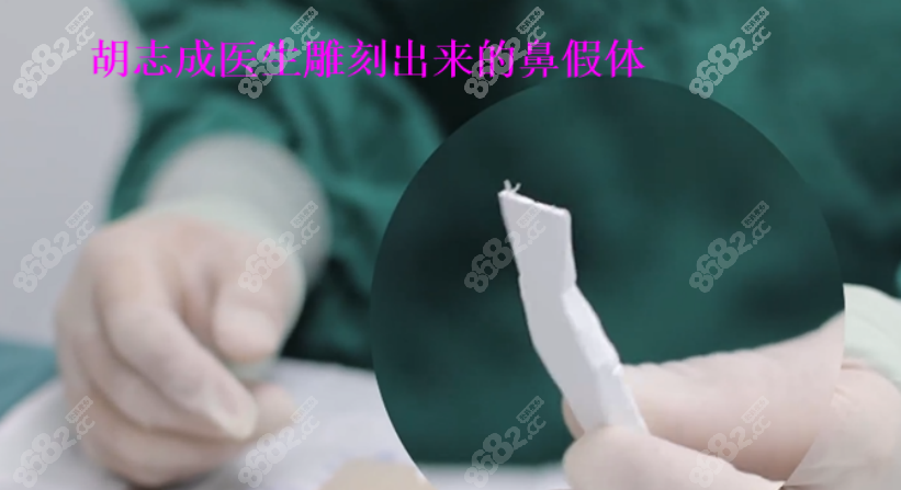 胡志成做鼻子怎么样？