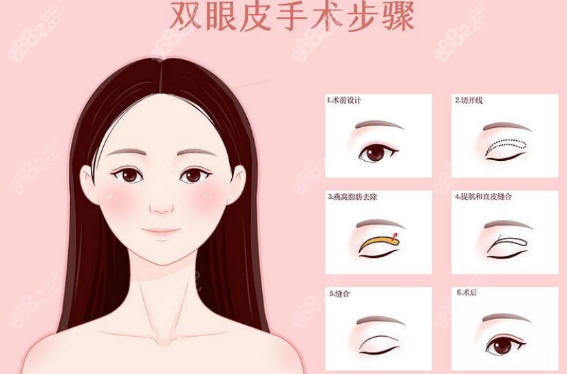 上海时光张晶医生怎么样？