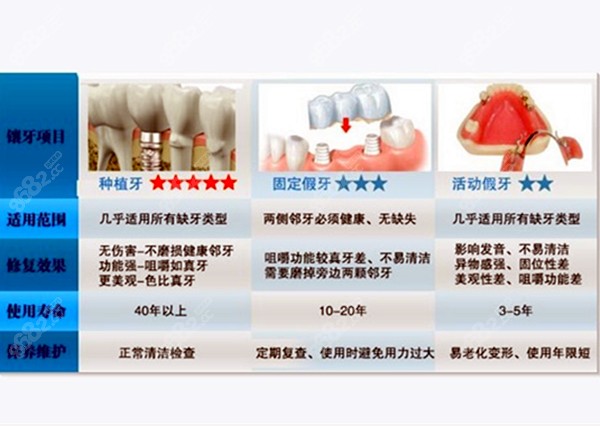 三种假牙的寿命对比