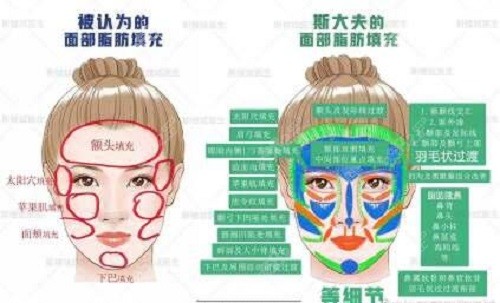 <!--<i data=20240705-sp></i>-->医生面部脂肪填充区域划分