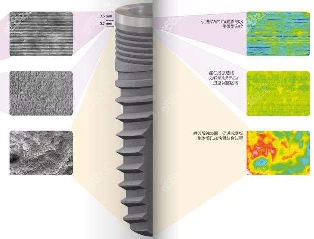 SKY种植体表面处理技术