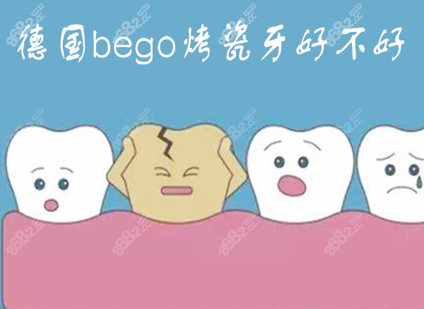 德国bego烤瓷牙好不好