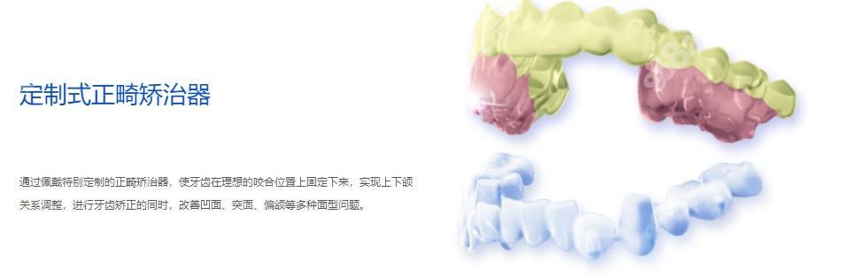 正雅牙套的特点