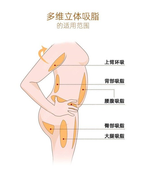 多维立体吸脂范围